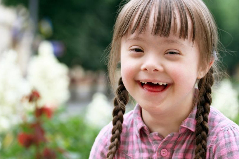 پیشگیری از عقب ماندگی ذهنی در کودکان