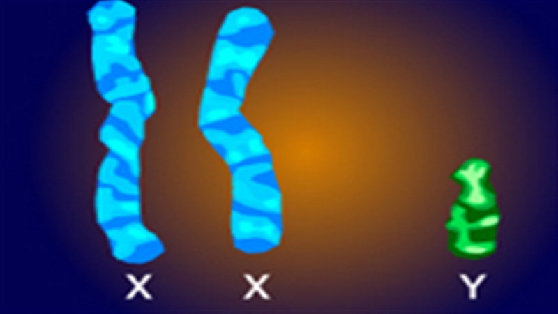 سندروم کلاین فلتر چیست؟ | بهترین آزمایشگاه ژنتیک اصفهان