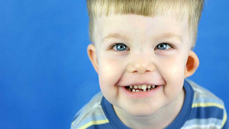 سندروم نشانگان ویلیامز چیست؟ | آزمایشگاه ژنتیک اصفهان