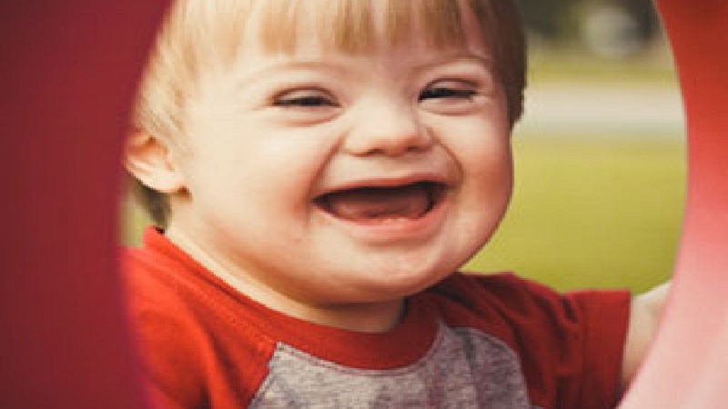 سندرم X شكننده چیست؟ | مشاوره ژنتیک اصفهان