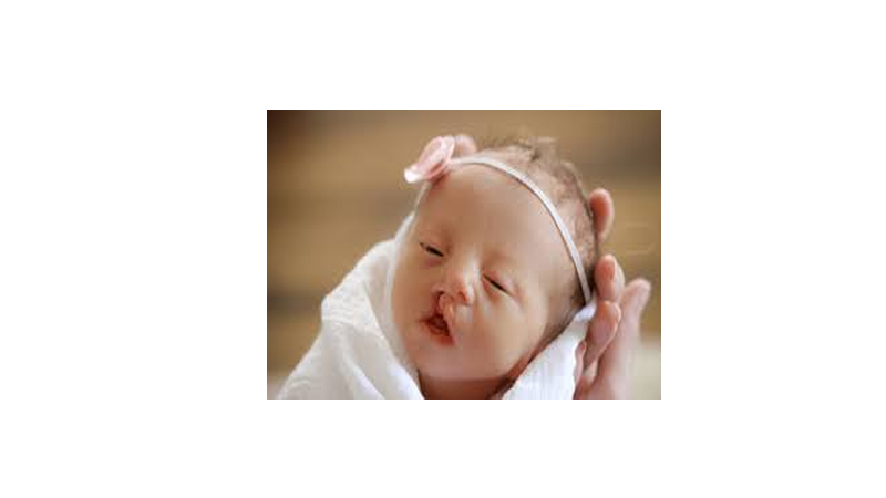 تشخیص بیماری سندرم ادوارد | آزمایش ژنتیک اصفهان