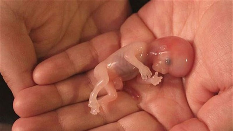 نکات موثر در مورد روشهای سقط جنین | بهترین آزمایشگاه ژنتیک اصفهان