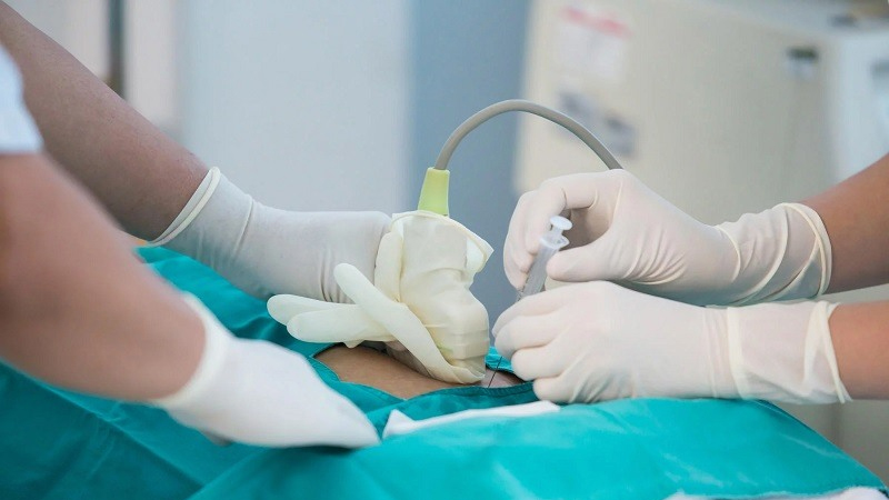 کاربرد آمینوسنتز در خانمهای باردار | بهترین آزمایشگاه ژنتیک اصفهان