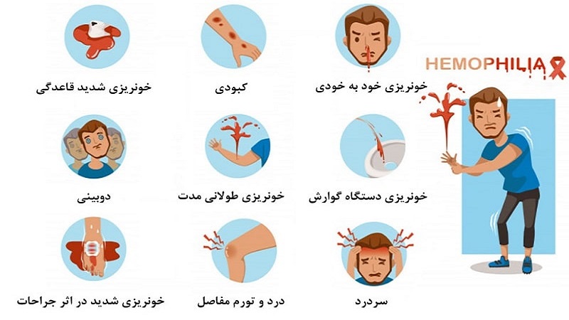 هموفیلی و انواع آن چیست؟ | مشاوره ژنتیک اصفهان