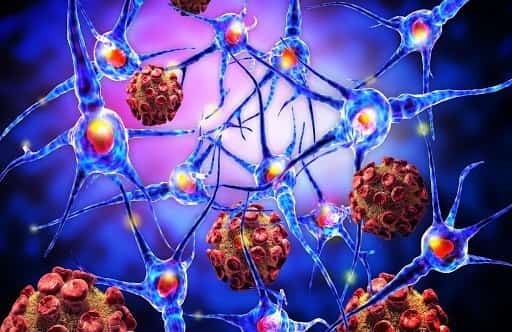 نوروفیبروماتوز نوع 1 (NF1)