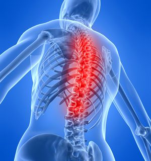 اختلالات عصبی و عضلانی