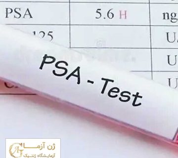 psa در سرطان پروستات | ژن آزما
