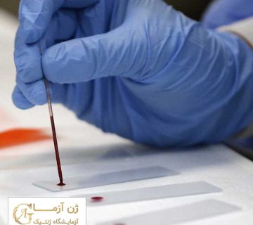 سل فری چگونه انجام میشود | ژن آزما