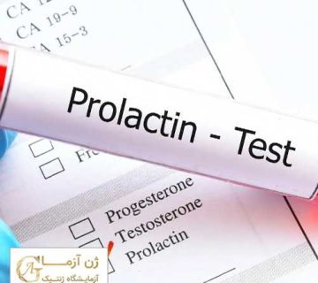 آزمایش پرولاکتین خون چیست
