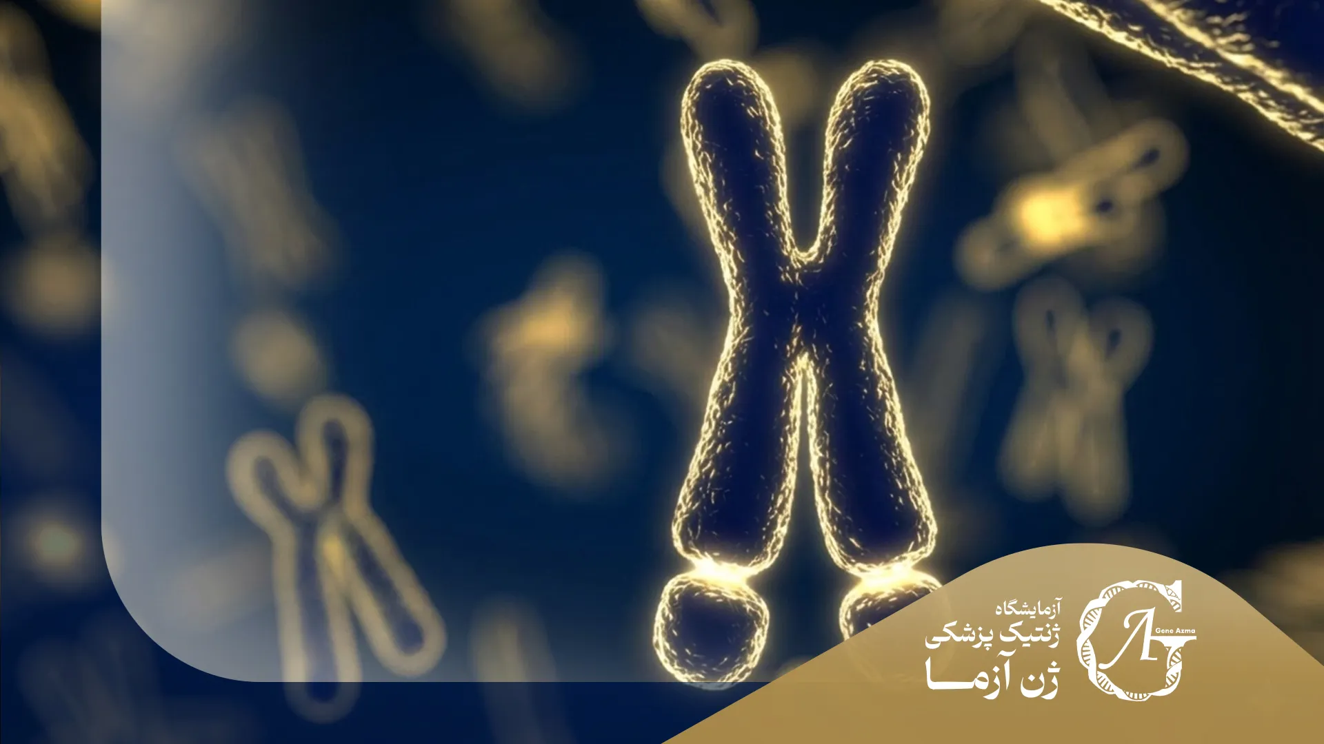 سندرم ایکس شکننده